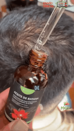 Cuero cabelludo con el pelo fino y ralo visto de cerca